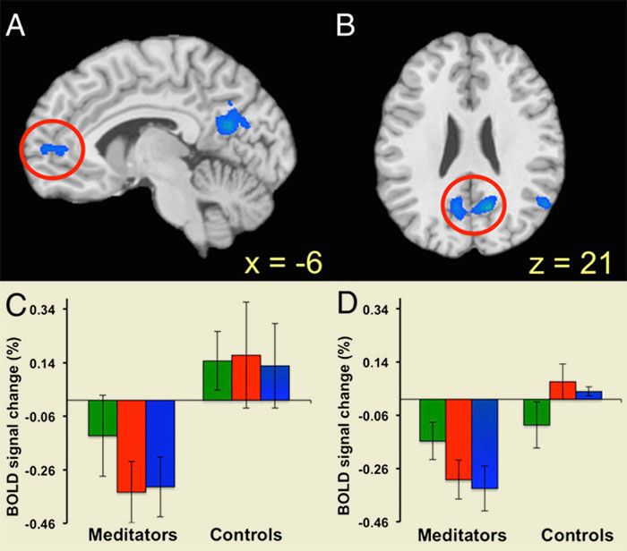 Brain scans showing the contrast between experienced meditators and beginners