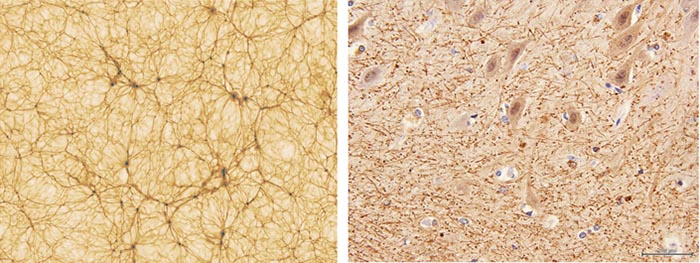 simulated matter distribution of cosmic web (left) and the observed distribution of neurons in the cerebellum of the human brain (right)